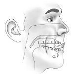 exercises to stop snoring